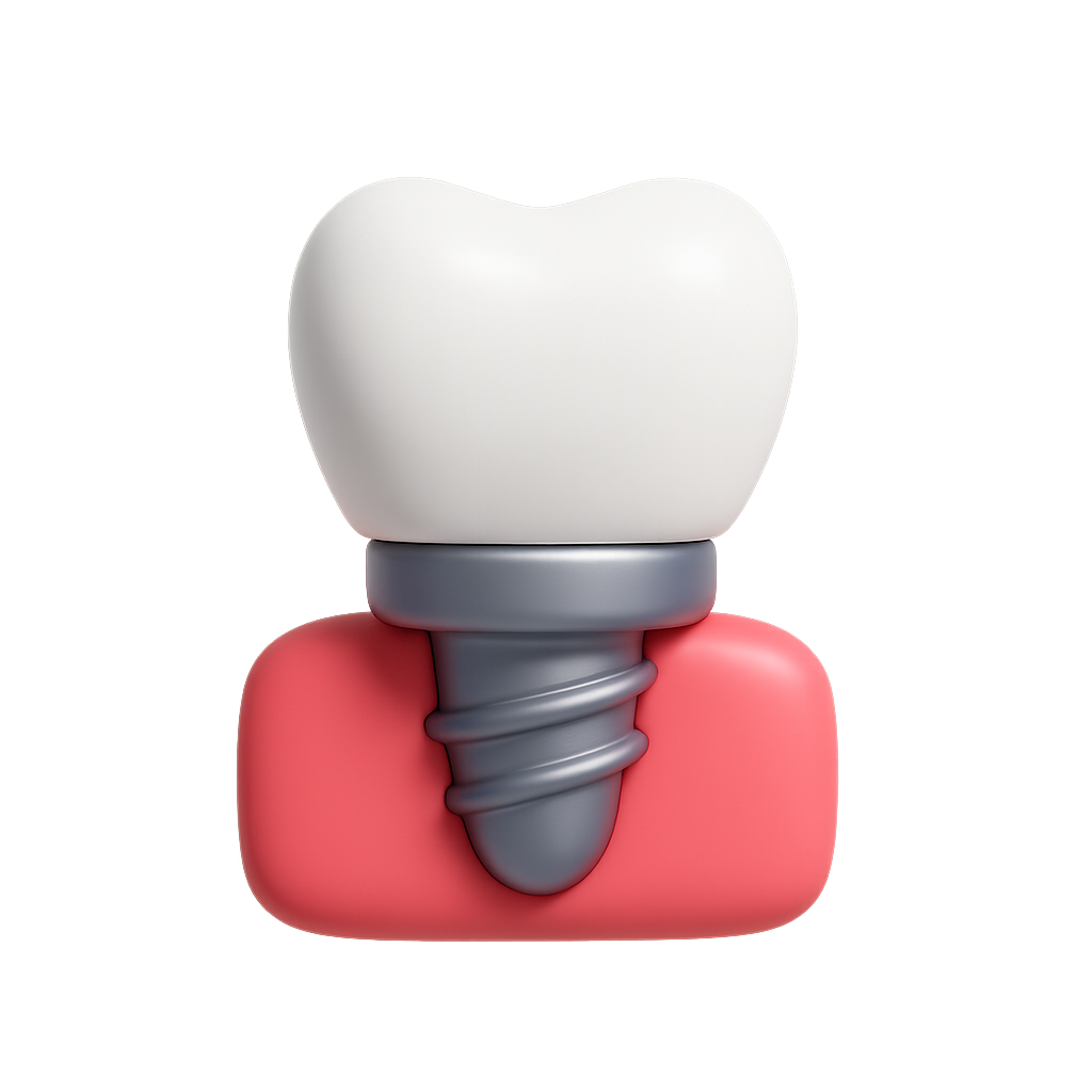 Имплантация